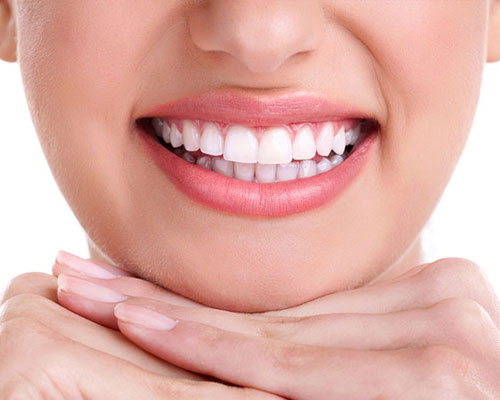 Smile Design treatment by Dr. Monika Sonawane, a highly respected dentist at All Dent, Dental Clinic in Ulwe, Navi Mumbai 